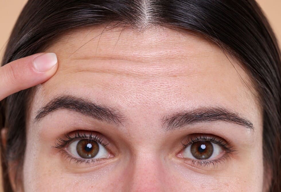 Primer plano de una mujer joven señalando finas arrugas y líneas de expresión en su frente.
